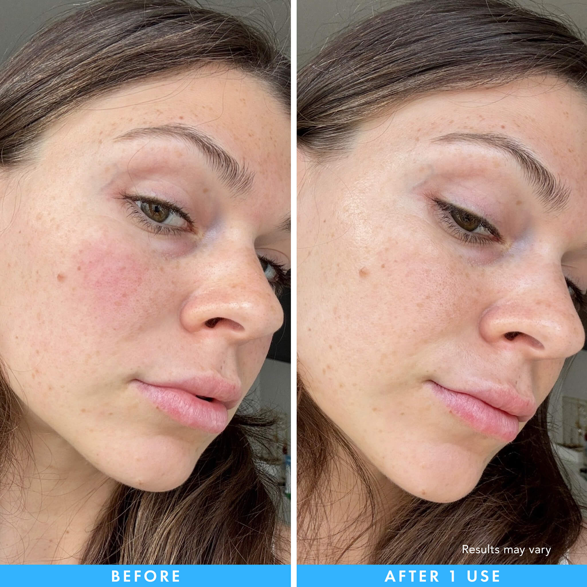 Cryo + Soothing Hydrogel Mask - Image 4