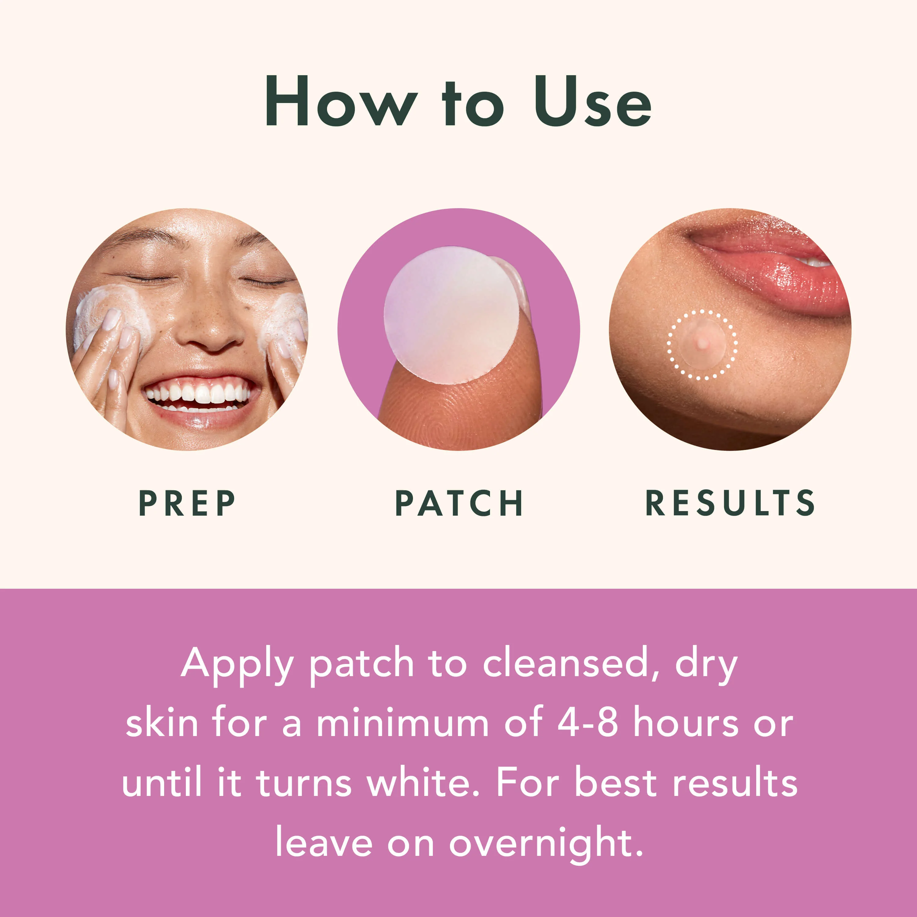 Miracle Patch Overnight Spot Cover - Image 3