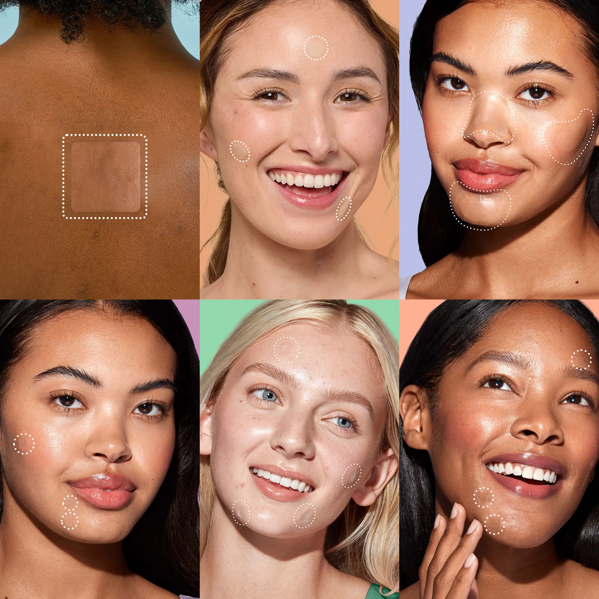 Miracle Patch Ultimate Pimple Patch Kit - Image 4